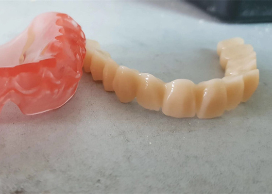 Realistische Digitale Gegevensoem 3D Gedrukte Tandmodellen voor Tandarts Study