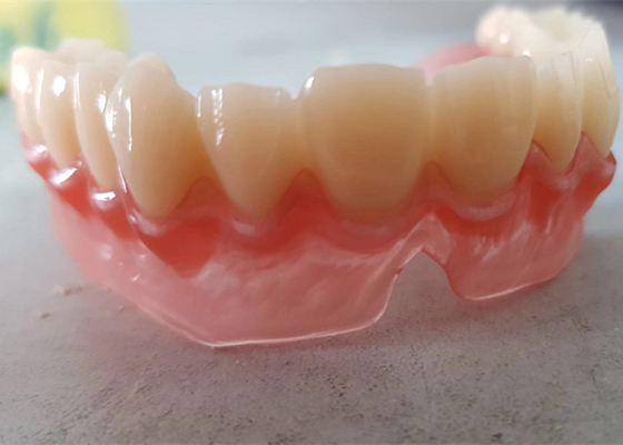 Realistische Digitale Gegevensoem 3D Gedrukte Tandmodellen voor Tandarts Study