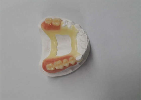 Natuurlijk kijk Rubber Tand de Kroon 3D Printer Dental Laboratory van PFM