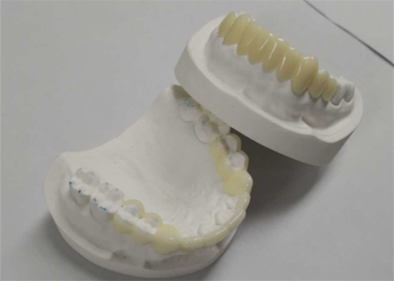Hoge duurzaamheid CAD CAM 3D-printen Tijdelijke kronen Duurzame hars