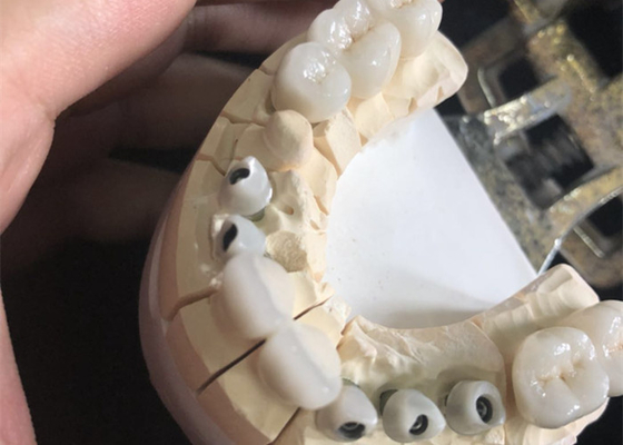 Tandkronen Uitstekende Biocompatibility van het metaal de Vrije Witte Zirconiumdioxyde