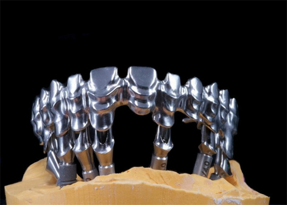 Implant van het de Kroonsteunpunt van FDA het Tand Natuurlijke Materiaal met hoge weerstand