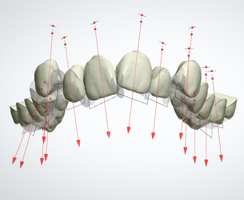 Goede Biocompatibility bevestigde Orthodontische Toestellen Rubberpal