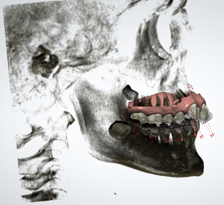 Het aangepaste Rubber bevestigde Orthodontische Gemakkelijke Toestellen handhaaft