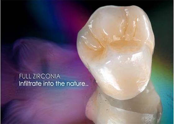 Ultra Harde Oppoetsende Implant van de Vernisje alle-Ceramische Kroon Gebitten Tand