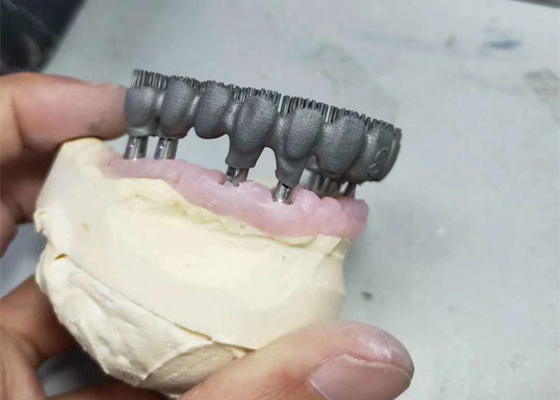 Duurzame CAD CAM PFM 3D Printer Dental Lab Prints voor Onderzoek