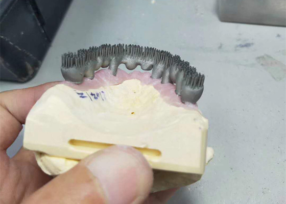 Duurzame CAD CAM PFM 3D Printer Dental Lab Prints voor Onderzoek