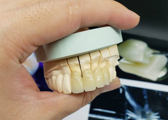 Veiligheids bekroont het Corrosiebestendige OEM Porselein Al Ceramische Natuurlijk kijkt