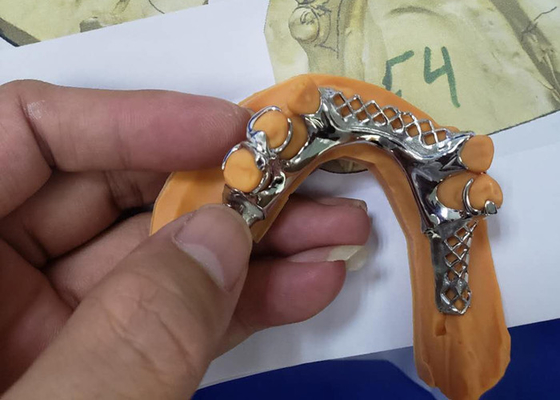 3D het Kadermodellen van de Druk Verwijderbare Tandkroon voor Tandheelkunde
