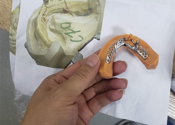 3D het Kadermodellen van de Druk Verwijderbare Tandkroon voor Tandheelkunde
