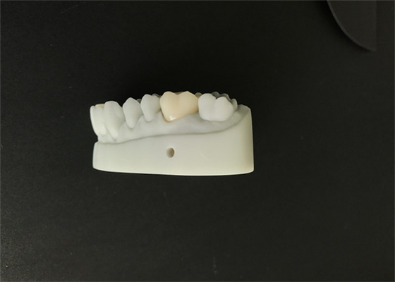 OEM 3D Gedrukt Tandmodellencad CAM Ontwerp voor Gebitlaboratorium