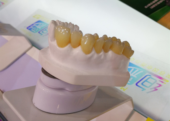 CAD CAM het Laboratorium 3D Printer Dental Crowns van de Ontwerppfm Tandkroon