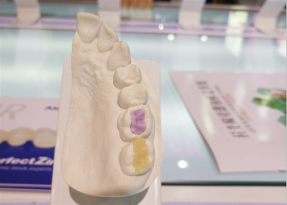 Hoge douane - van de Keramiekfda van de dichtheidsdouane de Tand alle-Ceramische Kroon