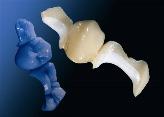 Aangepaste OEM die het alle-Ceramische Tandinlegsel Onlay oppoetsen van het Kroonvernisje