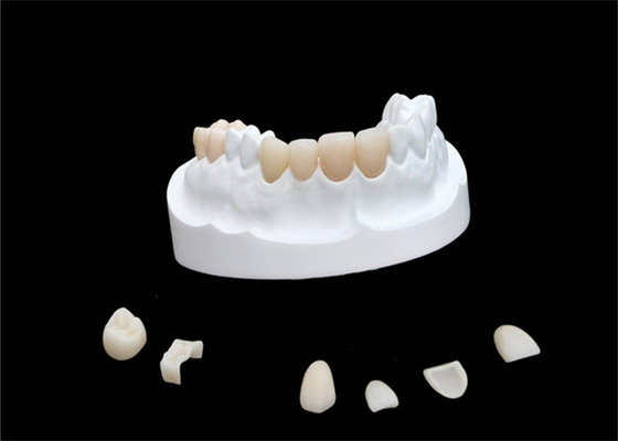 IPS E Max Ceramic Dental Crown Comfortable Porselein Samengestelde Vernisjes