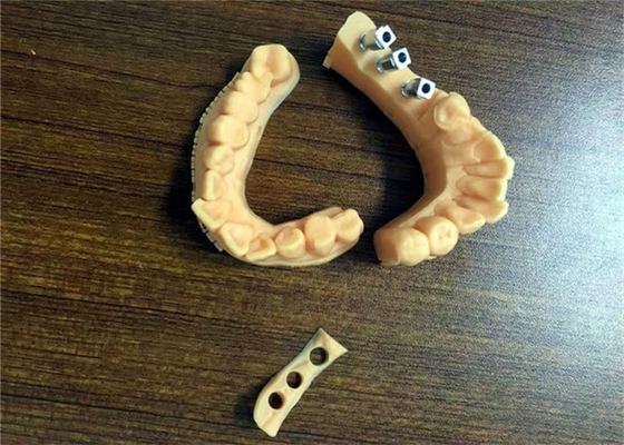 Porselein van de de Modellen TanddieKroon van FDA 3D Gedrukte Tand aan Metaal wordt gesmolten