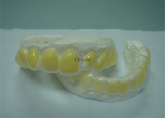 Zijn de Orthodontische Toestellen van FDA Corrosiebestendig en Duurzaam