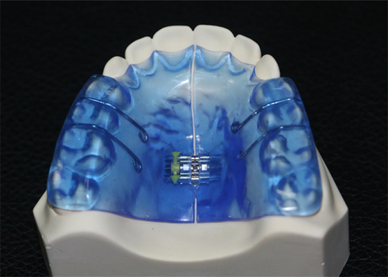 Orthopedische Tandinstrumenten met Hoge Stabiliteit en Goede Biocompatibility