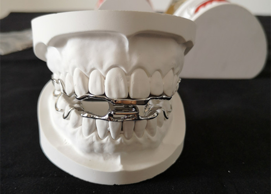 OEM Tand Orthodontisch Toestellen 3D Digitaal Ontwerp Met hoge weerstand