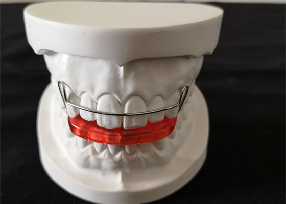 Douaneoem Eenvoudige de Orthodontie van het Tandinstelmechanisme installeert Gemakkelijk handhaaft