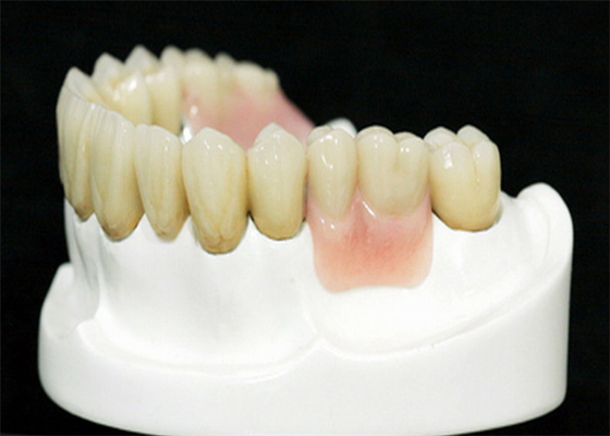 MK1 Precision Fixement Prothese voor perfecte pasvorm en bescherming