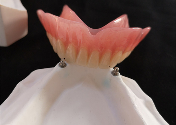 Hoge Biocompatibility-Implant van het Gebit cad-CAM van de Precisiegehechtheid