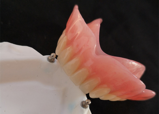 Hoge Biocompatibility-Implant van het Gebit cad-CAM van de Precisiegehechtheid