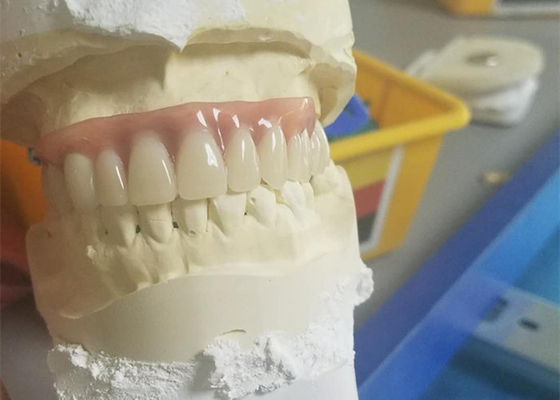 Het flexibele Duurzame Corrosiebestendige Gebit van de Precisiegehechtheid
