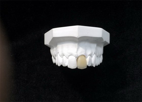 Het goede Biocompatibility-High-tech Biologische Materiaal van de Porselein Tandkroon