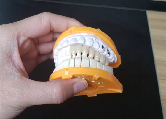 De Ceramische Kronen van de douanegrootte PFM voor Latere en Voorafgaande Tanden