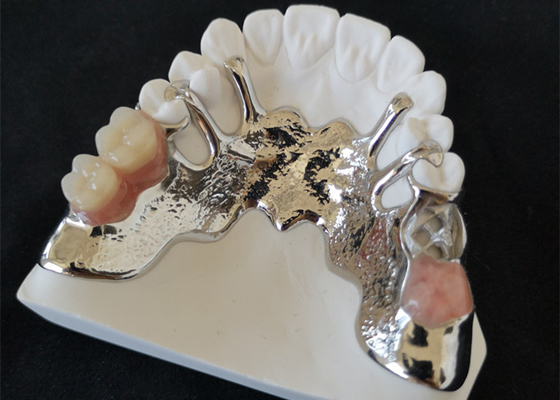 OEM 3D Brug Hoge Biologische Intermiscibility van Printerpfm Tandkronen