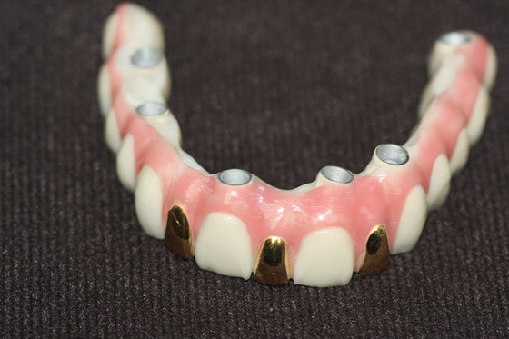 Implant van de precisie Digitaal 3D Druk Tand Gebaseerd Barmetaal