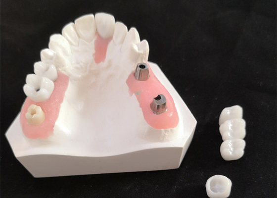 FDA Alle Zirconia kroon met implantaat ondersteunde tandheelkundige prothesen voor tandheelkundig laboratorium