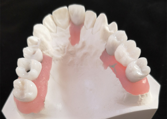 FDA Alle Zirconia kroon met implantaat ondersteunde tandheelkundige prothesen voor tandheelkundig laboratorium
