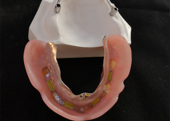Titanium/pure titanium tandheelkundige implantaatbalk voor CAD CAM Digital Center