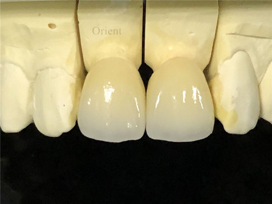 Keramische tandheelkundige kroon, Zirconia tandheelkundige kroon