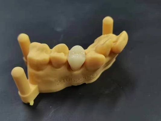 OEM 3D Tand het laboratorium Digitaal Ontwerp van het Druk Flexibel Acrylgebit