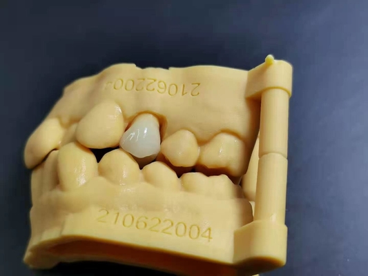 OEM 3D Tand het laboratorium Digitaal Ontwerp van het Druk Flexibel Acrylgebit
