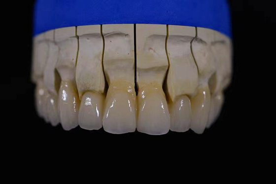 Lab voor de fabricage van tandheelkundige prothesen Volmaakt witte tandheelkundige prothesen met Zirconia Repair