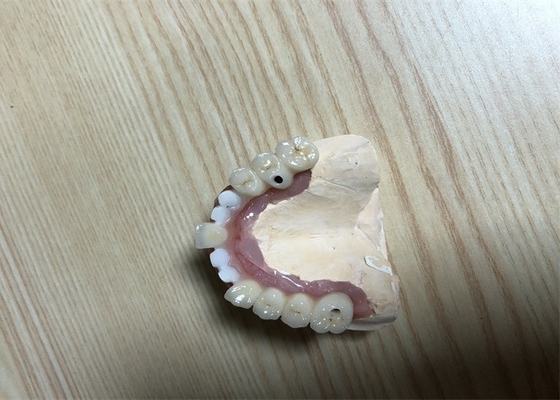 Nauwkeurige Implant van Biocompatibility Tandimplant van de Gehechtheidstand Kroon