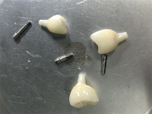 Zirconia-implantatherstel Geen kleurprobleem