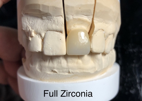 3D multi-level Full contour Zirconia Los het probleem van geen transparantie op