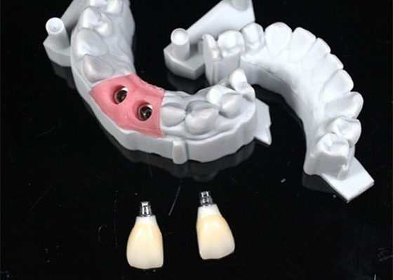 Precieze CAD/CAM-ontwerp Zirconia tandkroon voor montage