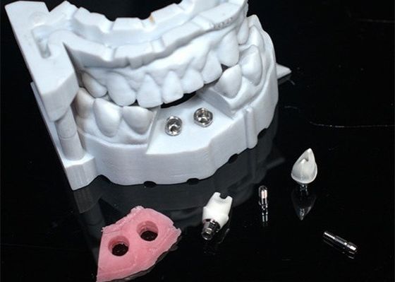 3D-model Zirconia kroon