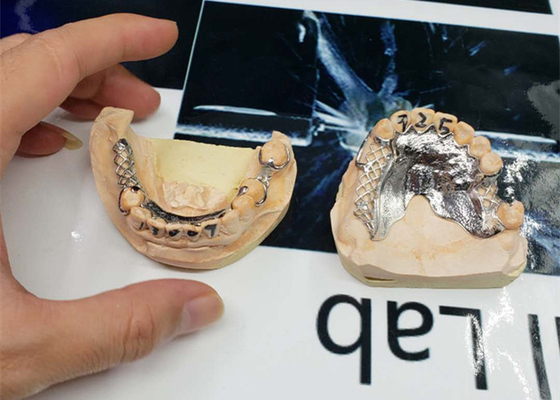 Hoge Nauwkeurigheids cad-CAM bevestigde het Verwijderbare Ontwerp van de Brugdigitalisering