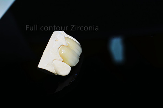Duurzame Volledige Ceramische Dunne Mooie de Douanevorm van de Zirconiumdioxydekroon