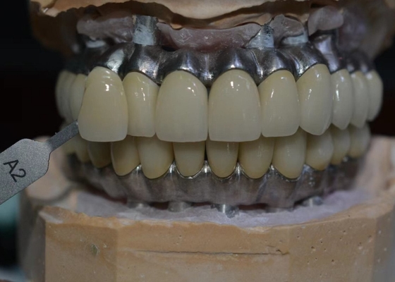 Het corrosiebestendige Co-van de het Metaalkroon van Cr Implant Gesteunde Biologische Materiaal