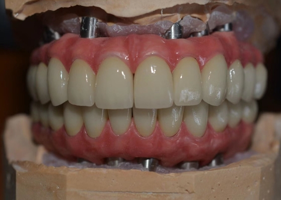 Het corrosiebestendige Co-van de het Metaalkroon van Cr Implant Gesteunde Biologische Materiaal