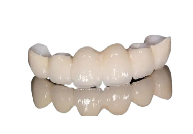 De corrosiebestendige Natuurlijke Verschijning van de Porselein Tandkroon voor Front Teeth/Achtertanden