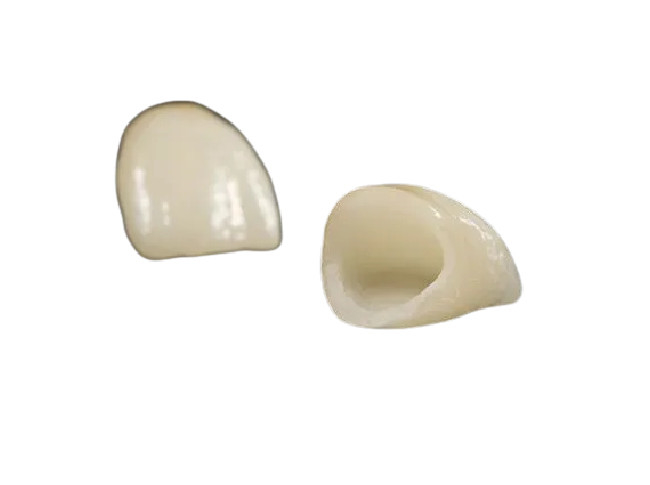Hoogst Biocompatibele Ceramische Tandkroon Realistische Mooie Kleuren Aangepaste Grootte